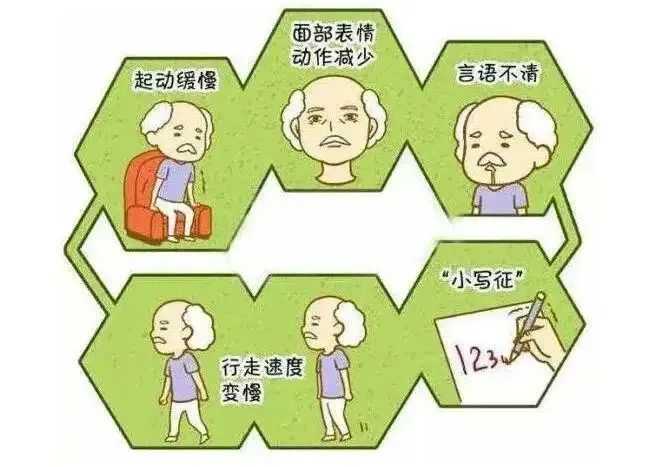 金色梦舞台，揭示帕金森病早期先兆