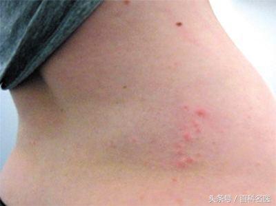 空气污染重注意防哮喘