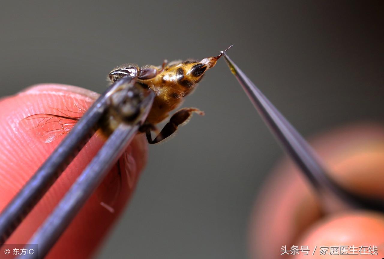 类风湿患者该注意些啥