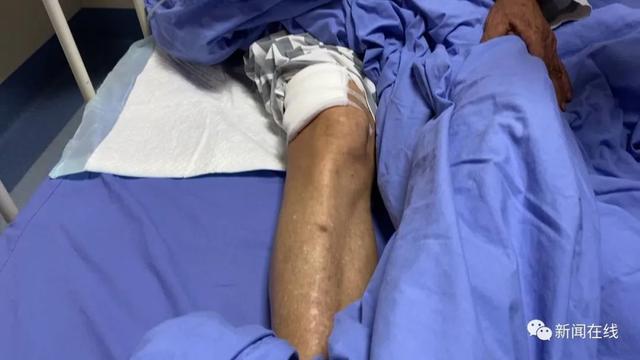 老年人在养老院遭遇咬伤事件，原因、影响与应对策略