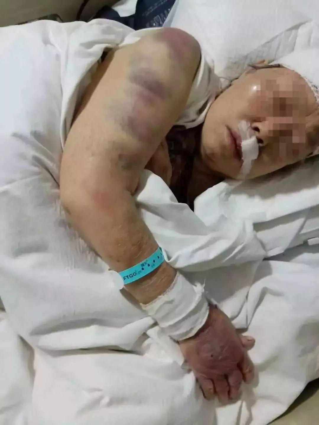 关于老年人死亡与养老金数额的思考